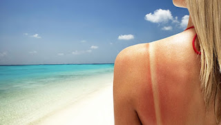 Yanık nasıl tedavi edilir? | TurkArama Motoru | Sağlık ve Günlük Yaşam için Pratik Bilgiler